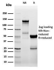 Anti-ZAP70 Rabbit Recombinant Antibody [Clone: ZAP70/6492R]