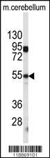 Anti-CPE Rabbit Polyclonal Antibody