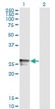 Anti-HLA-DMB Mouse Monoclonal Antibody [clone: 7D11]