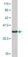 Anti-PPP1CB Mouse Polyclonal Antibody