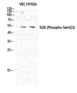 Western blot analysis of VEC HY926 cells using Anti-SGK (phospho Ser422) Antibody