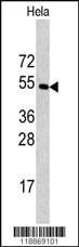 Anti-CPE Rabbit Polyclonal Antibody