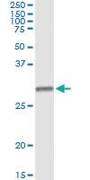 Anti-HLA-DMB Mouse Monoclonal Antibody [clone: 7D11]