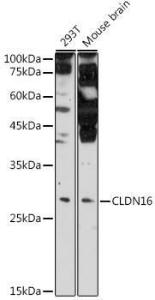 Anti-CLDN16/Claudin-16 Antibody (A10818)