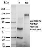 Anti-CSTF2T antibody