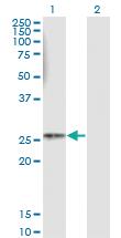 Anti-HLA-DMB Mouse Monoclonal Antibody [clone: 4D12]