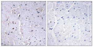 Immunohistochemical analysis of paraffin-embedded human heart using Anti-Pin1 (phospho Ser16) Antibody. The right hand panel represents a negative control, where the Antibody was pre-incubated with the immunising peptide