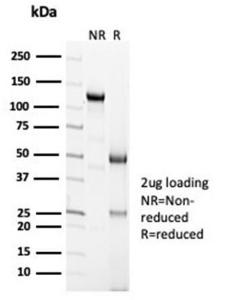 SDS-PAGE analysis of Anti-Calretinin Antibody [CALB2/7029R] under non-reduced and reduced conditions; showing intact IgG and intact heavy and light chains, respectively. SDS-PAGE analysis confirms the integrity and purity of the Antibody