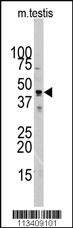 Anti-S100A1 Rabbit Polyclonal Antibody