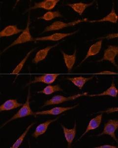 Immunofluorescence analysis of L929 cells using Anti-ALG5 Antibody (A307584) at a dilution of 1:100. DAPI was used to stain the cell nuclei (blue).