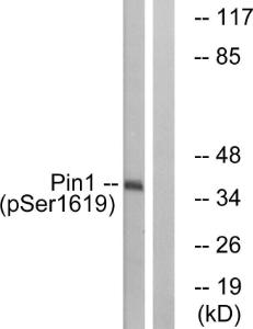 Western blot analysis of lysates from COS7 cells treated with insulin 0.01 U/ml 15' using Anti-Pin1 (phospho Ser16) Antibody. The right hand lane represents a negative control, where the Antibody is blocked by the immunising peptide