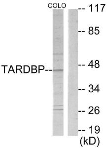 Western blot analysis of lysates from COLO205 cells using Anti-TBX1 Antibody. The right hand lane represents a negative control, where the antibody is blocked by the immunising peptide.