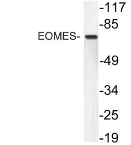 Western blot analysis of lysate from HT29 cells using Anti-EOMES Antibody