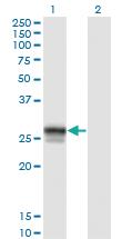 Anti-HLA-DMB Mouse Monoclonal Antibody [clone: 6E10]