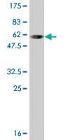 Anti-SULT1A1 Mouse Monoclonal Antibody [clone: 1F8]