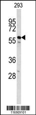 Anti-CDC14B Rabbit Polyclonal Antibody