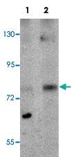 Anti-MRE11A Rabbit Polyclonal Antibody