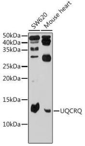 Western blot analysis of extracts of various cell lines, using Anti-Complex III Antibody (A10822) at 1:500 dilution The secondary antibody was Goat Anti-Rabbit IgG H&L Antibody (HRP) at 1:10,000 dilution Lysates/proteins were present at 25 µg per lane