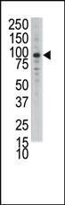 Anti-DDR1 Rabbit Polyclonal Antibody