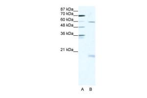 Anti-SOX9 Rabbit Polyclonal Antibody