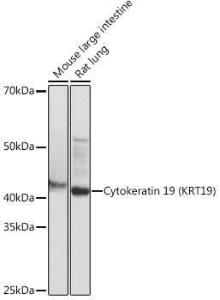 Western blot analysis of extracts of various cell lines, using Anti-Cytokeratin 19 Antibody [ARC0272] (A308569) at 1:1,000 dilution The secondary antibody was Goat Anti-Rabbit IgG H&L Antibody (HRP) at 1:10,000 dilution Lysates/proteins were present at 25 µg per lane