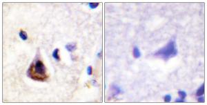 Immunohistochemical analysis of paraffin-embedded human brain tissue using Anti-PI3-kinase p85-alpha Antibody. The right hand panel represents a negative control, where the antibody was pre-incubated with the immunising peptide.