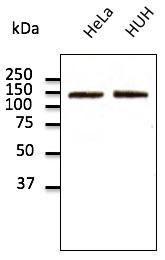 Endogenous CDH2 detected with Anti-N Cadherin Antibody at a 1:500 dilution. Lysates at 100 µg per lane and rabbit anti-goat IgG antibody (HRP) at a 1:10000 dilution