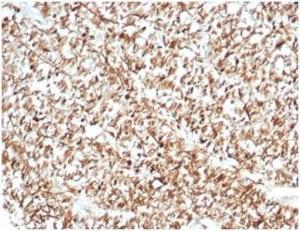 Immunohistochemical analysis of formalin-fixed, paraffin-embedded human brain tissue using Anti-Calretinin Antibody [CALB2/7029R]