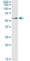 Anti-SLC11A1 Mouse Monoclonal Antibody [clone: 2G2]