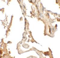 Anti-RILPL2 Rabbit Polyclonal Antibody