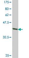 Anti-CADM1 Mouse Polyclonal Antibody