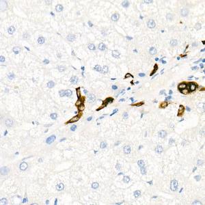 Immunohistochemistry analysis of paraffin-embedded human liver (negative control sample) using Anti-Cytokeratin 19 Antibody [ARC0272] (A308569) at a dilution of 1:100 (40x lens) Perform microwave antigen retrieval with 10 mM PBS buffer pH 72 before commencing with IHC staining protocol