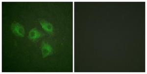 Immunofluorescence analysis of HeLa cells using Anti-PI3-kinase p85-alpha Antibody. The right hand panel represents a negative control, where the antibody was pre-incubated with the immunising peptide.