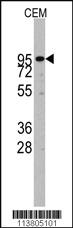 Anti-ADAM17 Rabbit Polyclonal Antibody