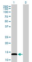 Anti-FABP4 Rabbit Polyclonal Antibody