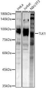 Western blot analysis of extracts of various cell lines, using Anti-TLK1 (phospho hospho S743) Antibody (A305864) at 1:1,000 dilution The secondary antibody was Goat Anti-Rabbit IgG H&L Antibody (HRP) at 1:10,000 dilution Lysates/proteins were present at 25 µg per lane