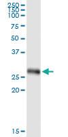 Anti-IFIH1 Polyclonal Antibody Pair