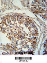 Anti-SACA1 Rabbit Polyclonal Antibody (AP (Alkaline Phosphatase))