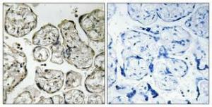 Immunohistochemical analysis of paraffin-embedded human placenta using Anti-PI3-kinase p85-alpha Antibody 1:100 (4°C overnight). The right hand panel represents a negative control, where the antibody was pre-incubated with the immunising peptide.