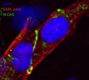 Human iPS-derived cardiomyocytes, fixed with methonal, stained with Anti-N Cadherin Antibody. The Anti-N Cadherin Antibody marks the intercalated disks, distal cell junctions in heart tissue (green line in the middle), of human iPS-derived cardiomyocytes