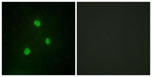 Immunofluorescence analysis of A549 cells using Anti-TBX1 Antibody. The right hand panel represents a negative control, where the antibody was pre-incubated with the immunising peptide.