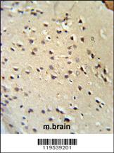 Anti-LMNB1 Rabbit Polyclonal Antibody