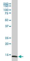 Anti-FABP4 Rabbit Polyclonal Antibody