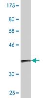 Anti-DHDH Mouse Monoclonal Antibody [clone: 3A11]