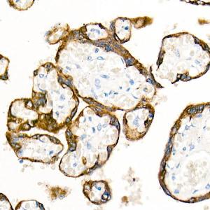 Immunohistochemistry analysis of paraffin-embedded human placenta using Anti-Cytokeratin 19 Antibody [ARC0272] (A308569) at a dilution of 1:100 (40x lens) Perform microwave antigen retrieval with 10 mM PBS buffer pH 72 before commencing with IHC staining protocol