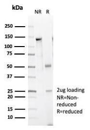 SDS-PAGE analysis of Anti-Caldesmon Antibody [CALD1/7024R] under non-reduced and reduced conditions; showing intact IgG and intact heavy and light chains, respectively. SDS-PAGE analysis confirms the integrity and purity of the antibody