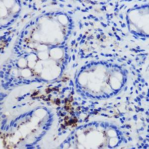 Immunohistochemistry analysis of paraffin-embedded human colon tissue using Anti-FPR1 Antibody (A305865) at a dilution of 1:50 (40x lens). Perform high pressure antigen retrieval with 10 mM citrate buffer pH 6.0 before commencing with IHC staining protocol.