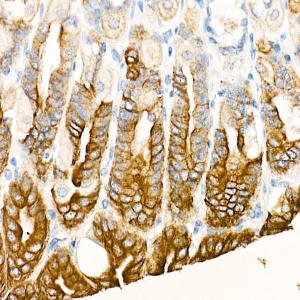 Immunohistochemistry analysis of paraffin-embedded mouse stomach using Anti-Cytokeratin 19 Antibody [ARC0272] (A308569) at a dilution of 1:100 (40x lens) Perform microwave antigen retrieval with 10 mM PBS buffer pH 72 before commencing with IHC staining protocol