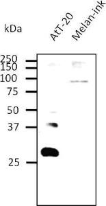 AtT-20 and Melan-ink cell lysates detected with Anti-RAB27B Antibody at a 1:500 dilution. Lysates at 100 µg per lane and rabbit anti-goat IgG antibody (HRP) at a 1:10,000 dilution