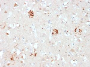 Immunohistochemical analysis of formalin-fixed, paraffin-embedded human brain using Anti-Ubiquitin Antibody [UBB/2122]